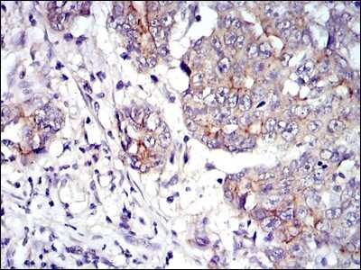 Immunohistochemistry: gamma Catenin Antibody (4C12) - BSA Free [NBP2-37557]
