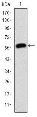 Western Blot: gamma Catenin Antibody (4C12)BSA Free [NBP2-37557]