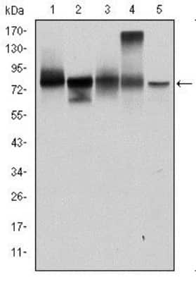 Western Blot: gamma Catenin Antibody (4C12)BSA Free [NBP2-37557]