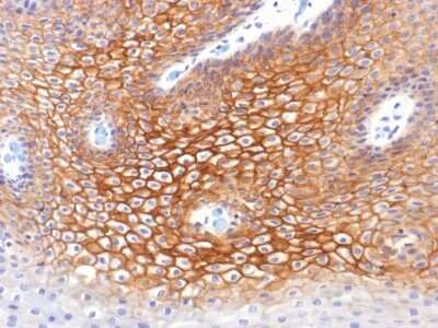 Immunohistochemistry-Paraffin: gamma Catenin Antibody (CTNG/1483) - Azide and BSA Free [NBP2-54525]