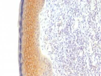 Immunohistochemistry-Paraffin: gamma Catenin Antibody (CTNG/1483) - Azide and BSA Free [NBP2-54525]