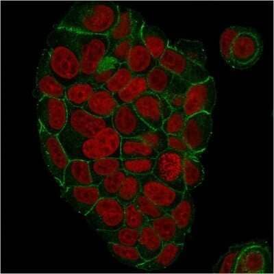 Immunocytochemistry/ Immunofluorescence: gamma Catenin Antibody (CTNG/1664) - Azide and BSA Free [NBP2-54524]