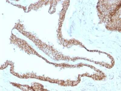 Immunohistochemistry-Paraffin: gamma Catenin Antibody (CTNG/1664) - Azide and BSA Free [NBP2-54524]
