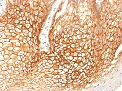 Immunohistochemistry-Paraffin: gamma Catenin Antibody (CTNG/1664) [NBP2-53172]