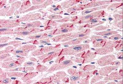 Immunohistochemistry-Paraffin: gamma Catenin Antibody [NB100-1060]