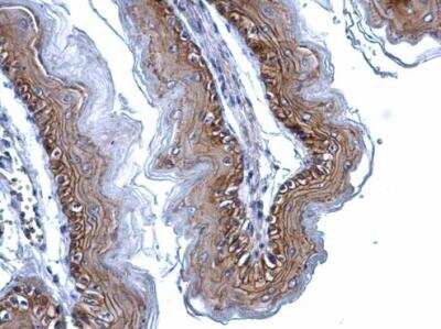Immunohistochemistry-Paraffin: gamma Catenin Antibody [NBP2-16600]