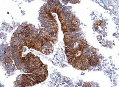 Immunohistochemistry-Paraffin: gamma Catenin Antibody [NBP2-16600]