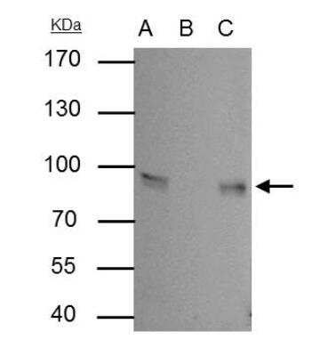Immunoprecipitation: gamma Catenin Antibody [NBP2-16600]