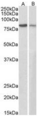 Western Blot: gamma Catenin Antibody [NB100-1060]