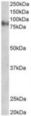 Western Blot: gamma Catenin Antibody [NB100-1060]