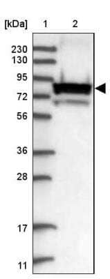 Western Blot: gamma Catenin Antibody [NBP2-33965]