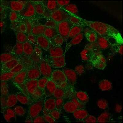 Immunocytochemistry/ Immunofluorescence: gamma Catenin Antibody (rCTNG/1664) - Azide and BSA Free [NBP3-08469]