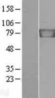 Western Blot: gamma Catenin Overexpression Lysate [NBL1-12118]