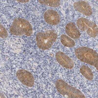 Immunohistochemistry-Paraffin: gamma-Glutamylcyclotransferase/CRF21/GGCT Antibody [NBP1-86727]