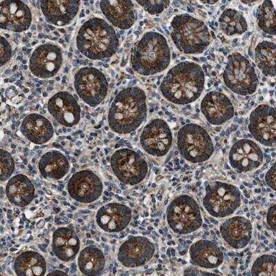 Immunohistochemistry-Paraffin: gamma-Glutamylcyclotransferase/CRF21/GGCT Antibody [NBP1-86728]