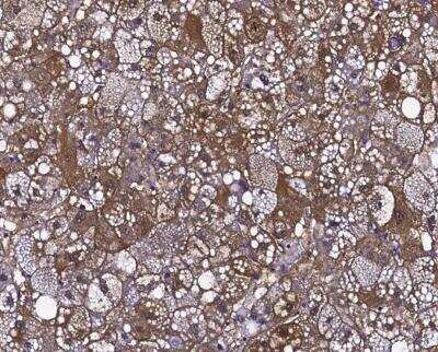 Immunohistochemistry-Paraffin: gamma-Glutamylcyclotransferase/CRF21/GGCT Antibody [NBP3-12540]