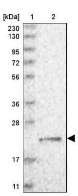 Western Blot: gamma-Glutamylcyclotransferase/CRF21/GGCT Antibody [NBP1-86727]