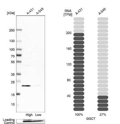 Western Blot: gamma-Glutamylcyclotransferase/CRF21/GGCT Antibody [NBP1-86728]