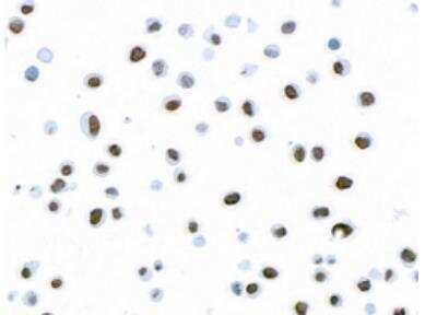 Histone H2AX [p Ser139] Antibody (BLR053F) (NBP3-14678) by