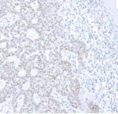 Immunohistochemistry-Paraffin: Histone H2AX [p Ser139] Antibody (BLR053F) [NBP3-14678]