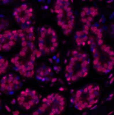 Immunohistochemistry-Paraffin: Histone H2AX [p Ser139] Antibody (BLR053F) [NBP3-14678]