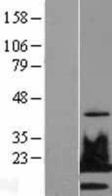 Western Blot: Histone H2AX Overexpression Lysate [NBL1-11424]