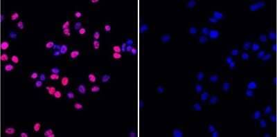 Histone H2AX [p Ser139] Antibody (3F2) (NB100-74435) by