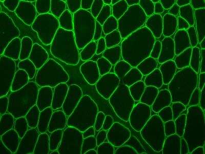 Immunohistochemistry-Frozen: gamma Sarcoglycan Antibody [NBP1-90299]