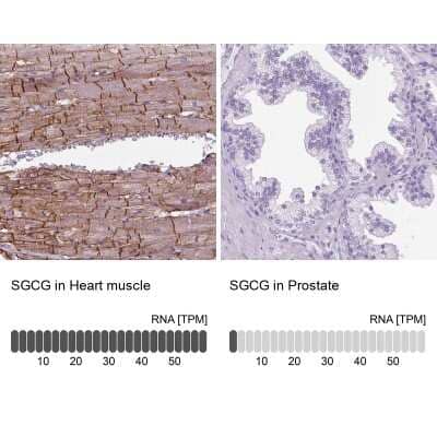 Immunohistochemistry-Paraffin: gamma Sarcoglycan Antibody [NBP1-90299]