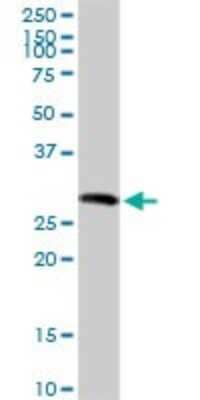 Western Blot: gamma Sarcoglycan Antibody [H00006445-D01P]