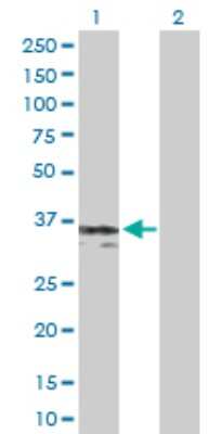Western Blot: gamma Sarcoglycan Antibody [H00006445-D01P]