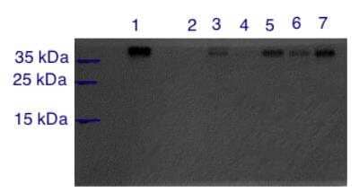 Western Blot: gamma Sarcoglycan Antibody [NBP1-59744]