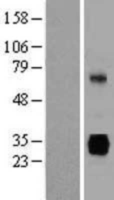 Western Blot: gamma Sarcoglycan Overexpression Lysate [NBP2-11158]