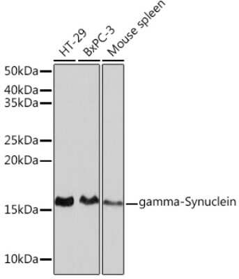 Western Blot: gamma-Synuclein Antibody (4A0F4) [NBP3-16144]