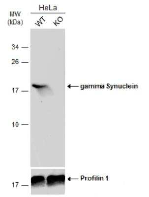 Western Blot: gamma-Synuclein Antibody [NBP1-31209]
