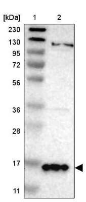 Western Blot: gamma-Synuclein Antibody [NBP1-89996]