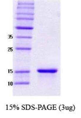 SDS-PAGE: Recombinant Human gamma-Synuclein Protein [NBC1-18329]