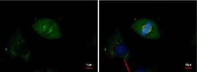 Immunocytochemistry/ Immunofluorescence: gamma Tubulin Antibody (4511) [NBP2-43585]