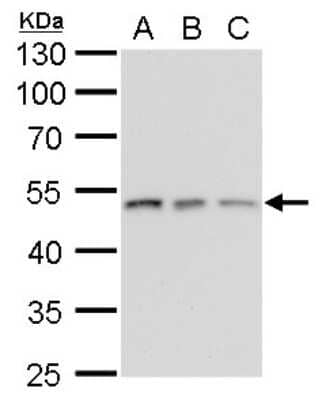 Western Blot: gamma Tubulin Antibody (4511) [NBP2-43585]