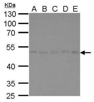 Western Blot: gamma Tubulin Antibody (4511) [NBP2-43585]