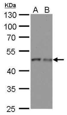 Western Blot: gamma Tubulin Antibody (4511) [NBP2-43585]