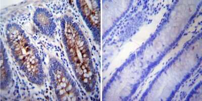 Immunohistochemistry-Paraffin: gamma Tubulin Antibody (4D11) [NB100-74421]