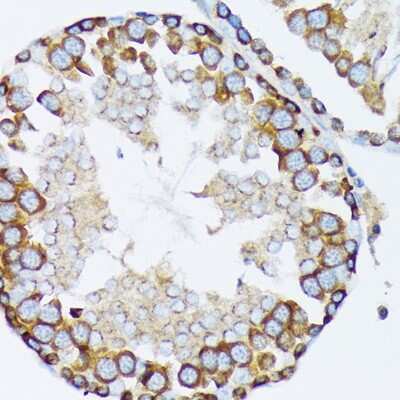 Immunohistochemistry-Paraffin: gamma Tubulin Antibody (5R3N3) [NBP3-16852]