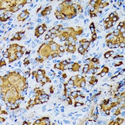 Immunohistochemistry-Paraffin: gamma Tubulin Antibody (5R3N3) [NBP3-16852]