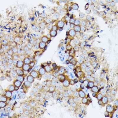 Immunohistochemistry-Paraffin: gamma Tubulin Antibody (5R3N3) [NBP3-16852]