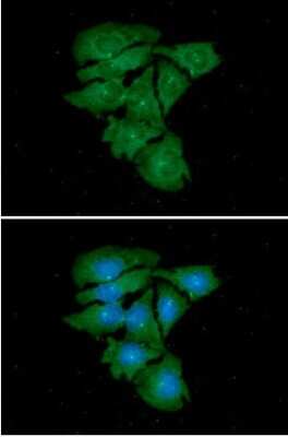 Immunocytochemistry/ Immunofluorescence: gamma Tubulin Antibody (9D6) - BSA Free [NBP2-60245]