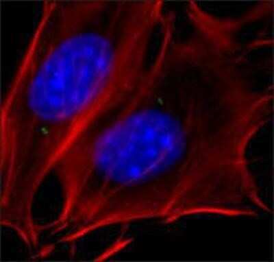 Immunocytochemistry/ Immunofluorescence: gamma Tubulin Antibody [NB120-11318]