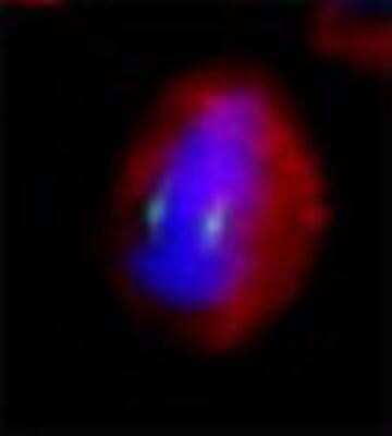 Immunocytochemistry/ Immunofluorescence: gamma Tubulin Antibody [NB120-11318]