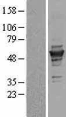 Western Blot: gamma Tubulin Overexpression Lysate [NBL1-17444]