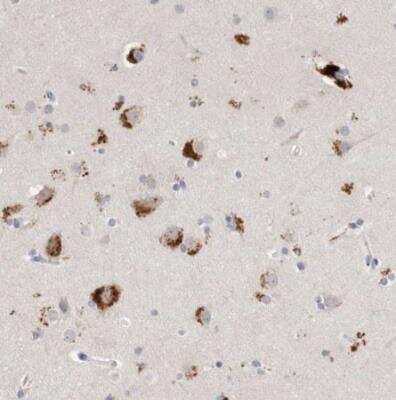 Immunohistochemistry-Paraffin: gamma-glutamyl hydrolase Antibody [NBP1-90927]